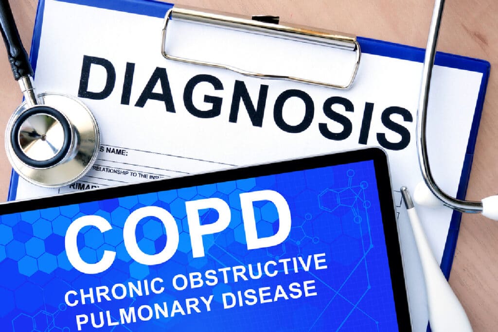 Home Care in San Jose CA: COPD