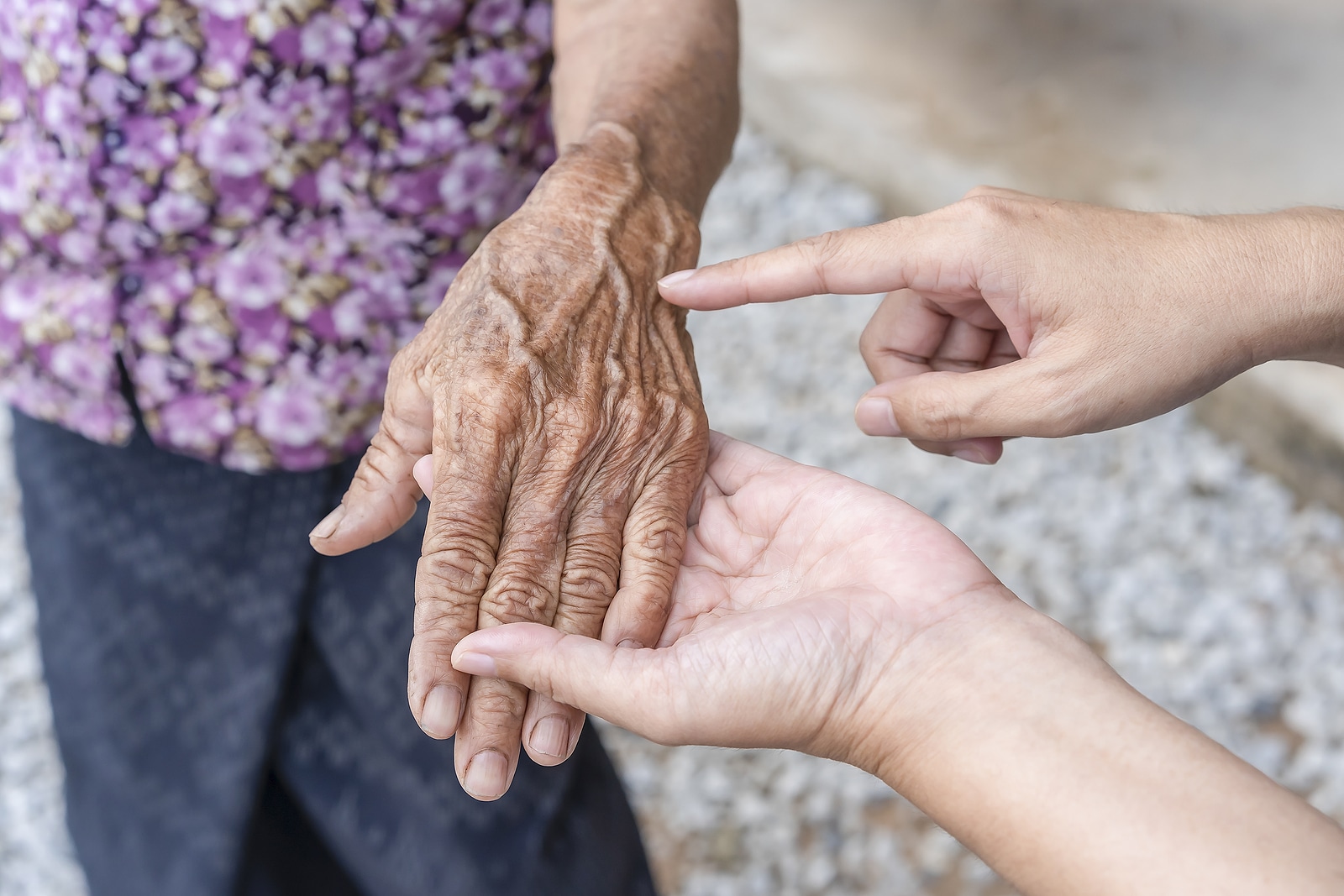 Personal Care at Home Can Help Seniors Manage Skin Conditions - HomeCare  Professionals